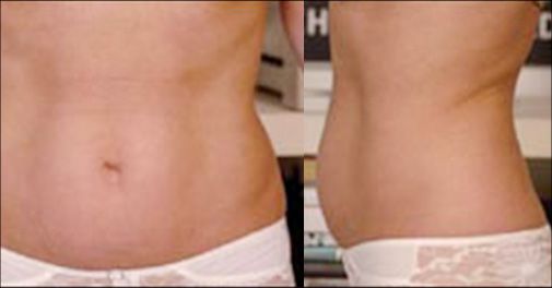 Deal banner image 2