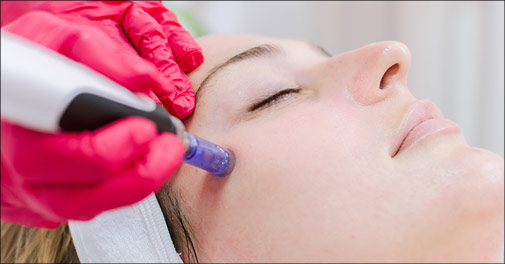 Super alternativ til Botox!