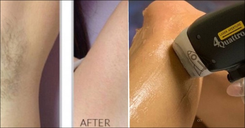 Deal banner imeage 3